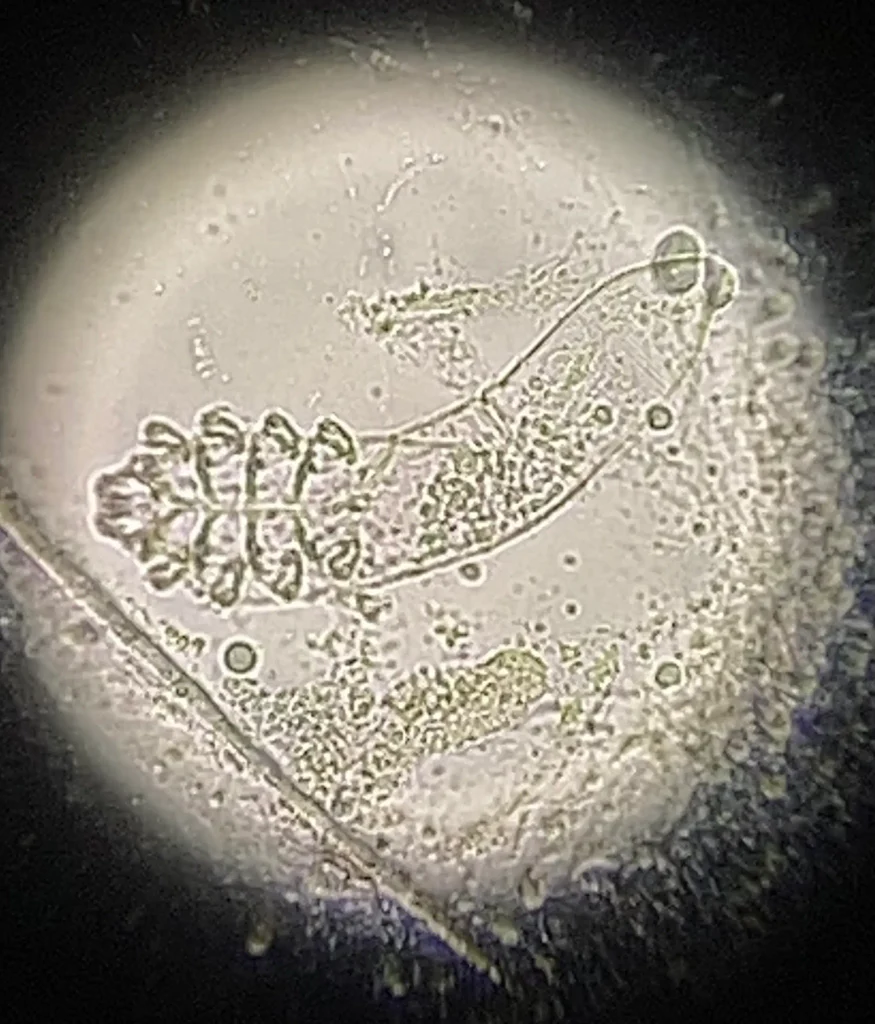 酒さの皮膚から検出したニキビダニの実物の写真
