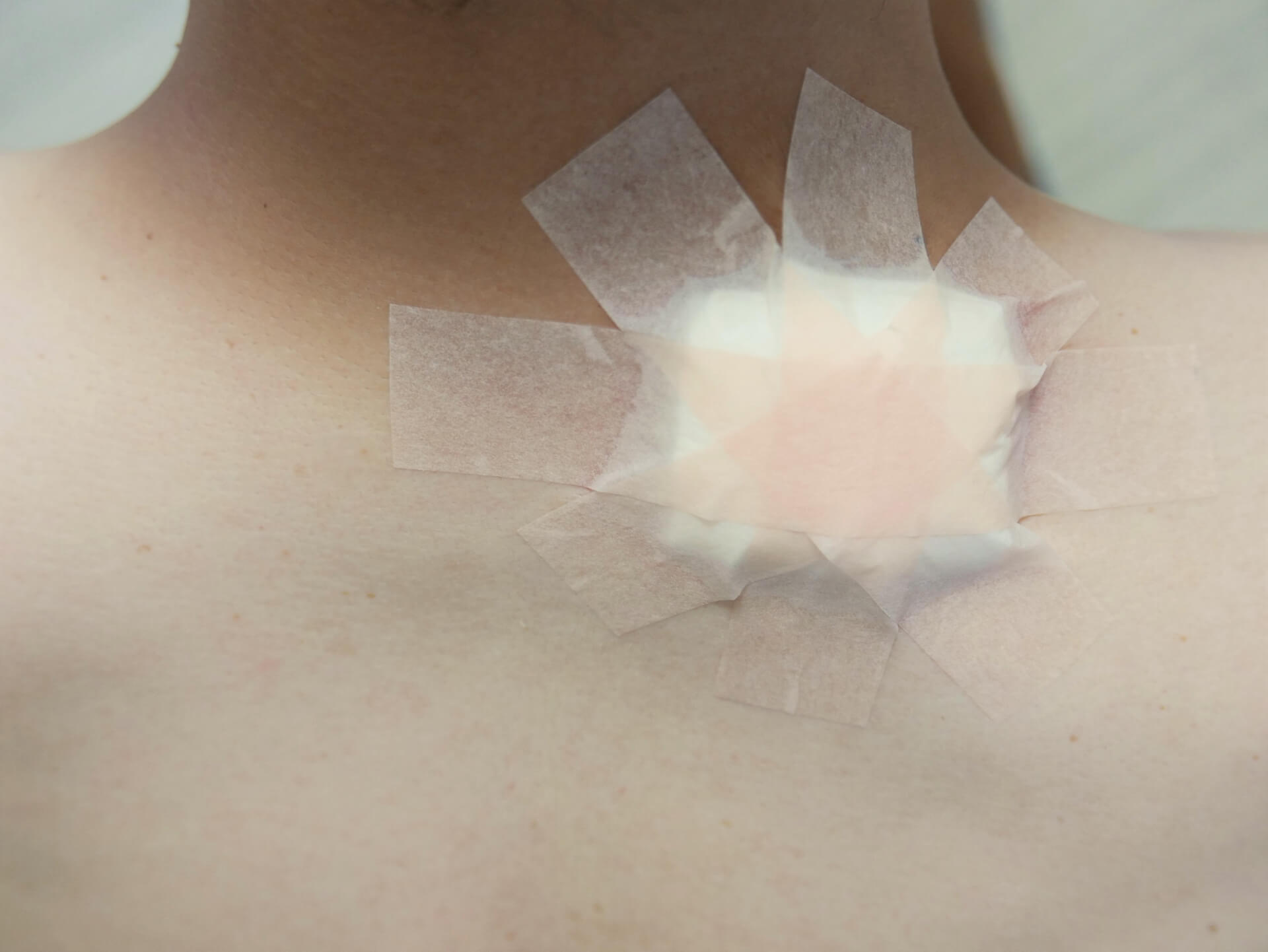 手術前に知っておきたい麻酔と切開の準備